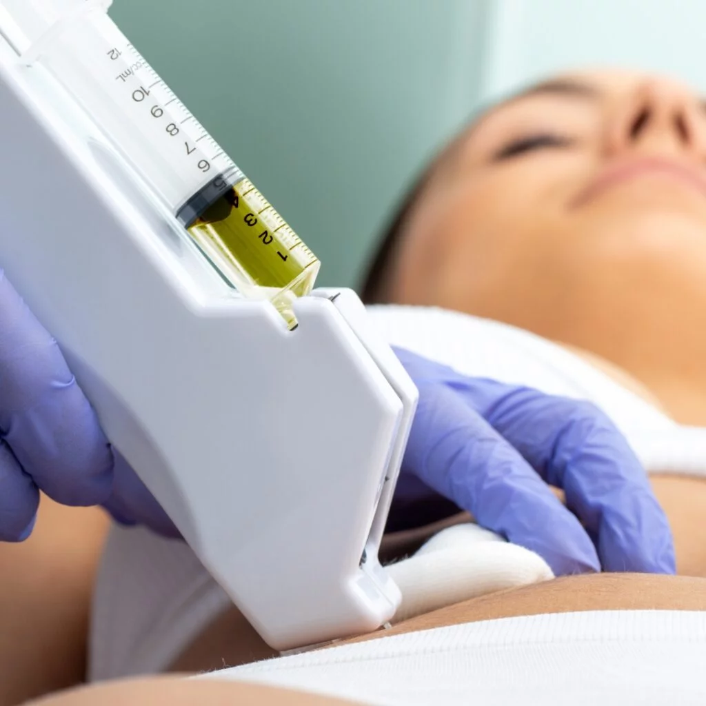 Tratamientos Corporales 4 Mesoterapia abdomen para reducir grasa